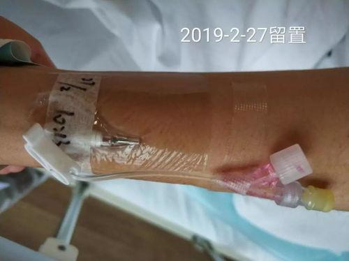 成人留置针视频教程