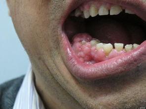 成人牙床图片大全视频,揭秘牙齿排列与口腔健康